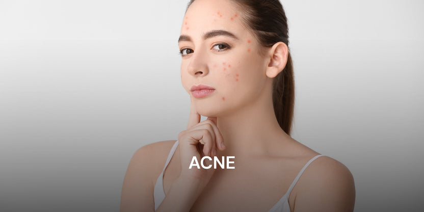 Skin Root Collections – Skin & Roots