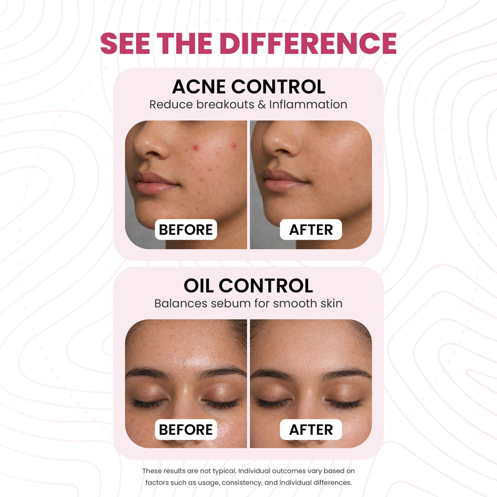 Glow & Hydrating Face Wash | 5% Niacinamide & 2% Salicylic Acid | Clear and Even Skin