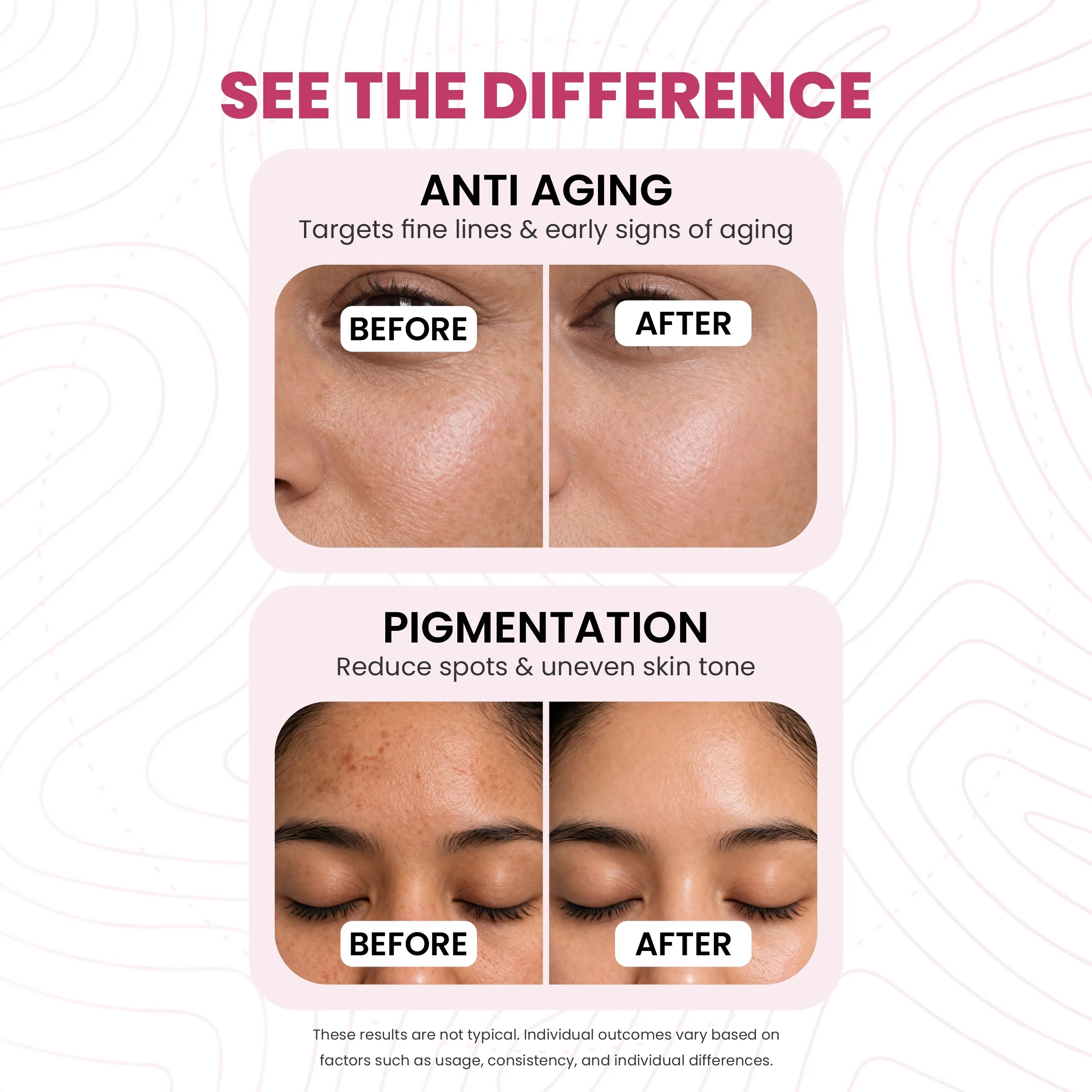 Age Defy Serum | 10% Niacinamide & 0.2% Bakuchiol | Anti-Aging & Brightening