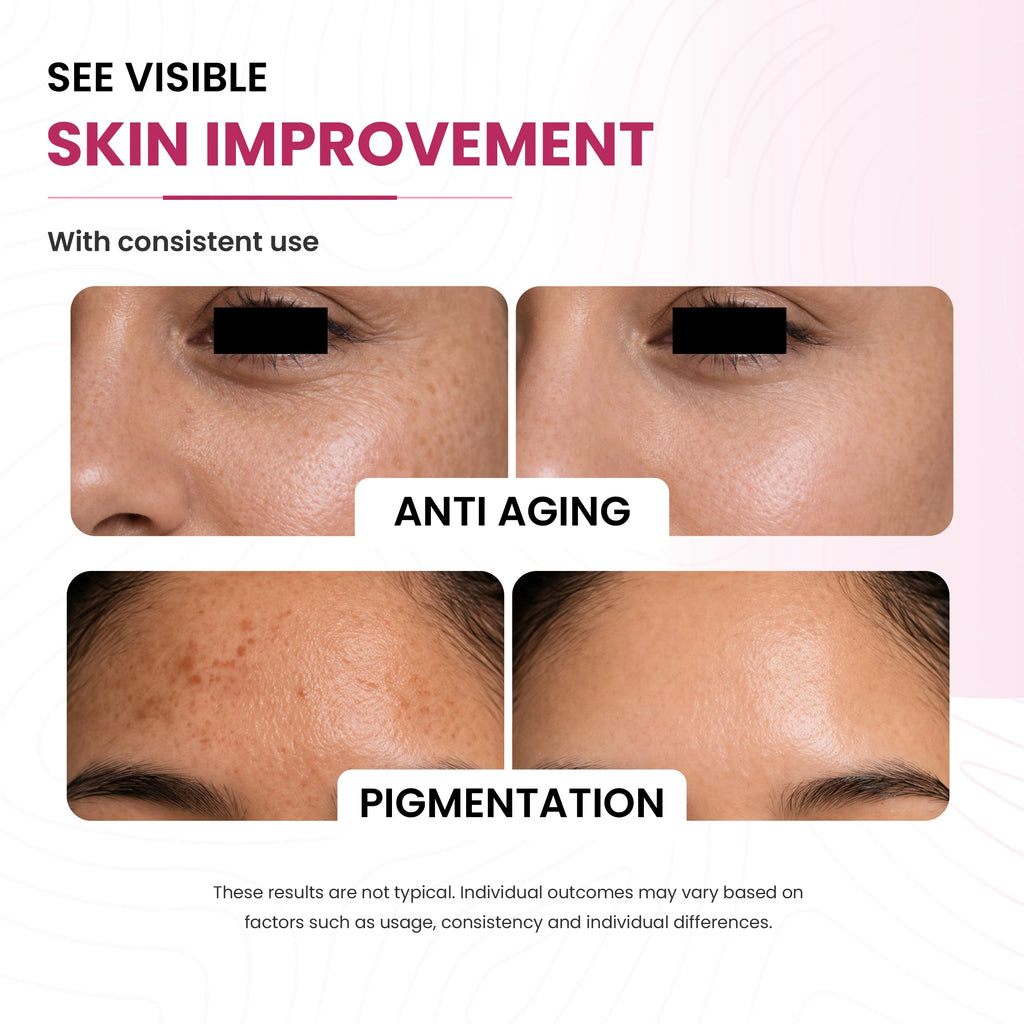 Age Defy Serum | 10% Niacinamide & 0.2% Bakuchiol | Anti-Aging & Brightening