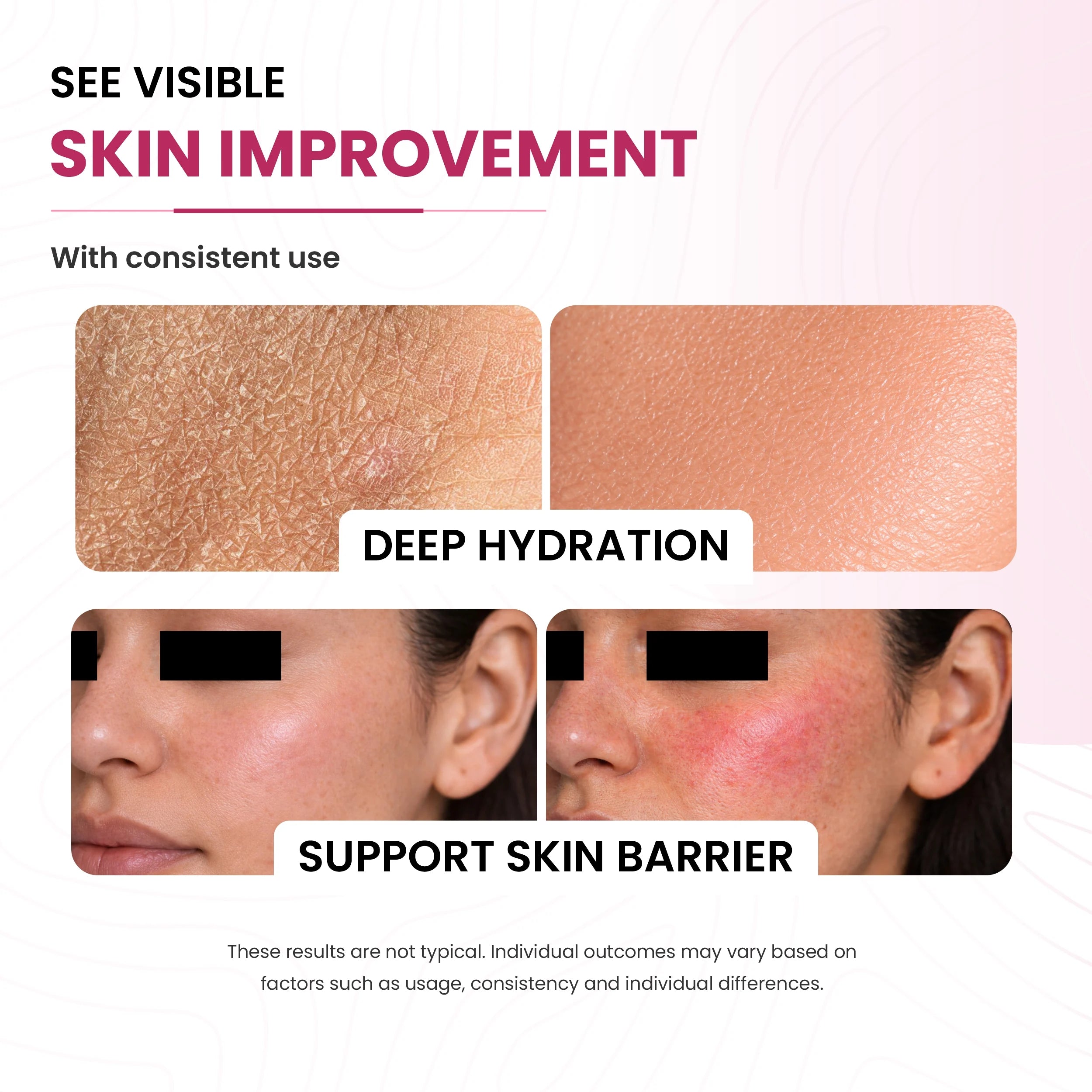 Snail Mucin Repair Moisturizer | Snail Mucin & Polyglutamic Acid | Lock Moisture 4x & Cell Repair