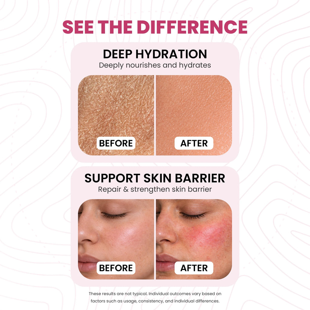 Snail Mucin Repair Moisturizer | Snail Mucin & Polyglutamic Acid | Lock Moisture 4x & Cell Repair