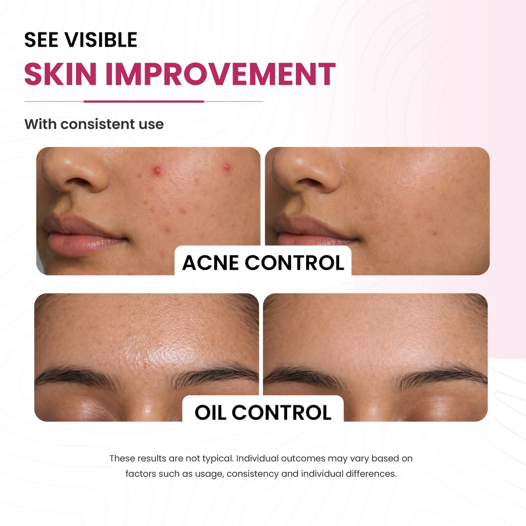 Glow & Hydrating Face Wash | 5% Niacinamide & 2% Salicylic Acid | Clear and Even Skin