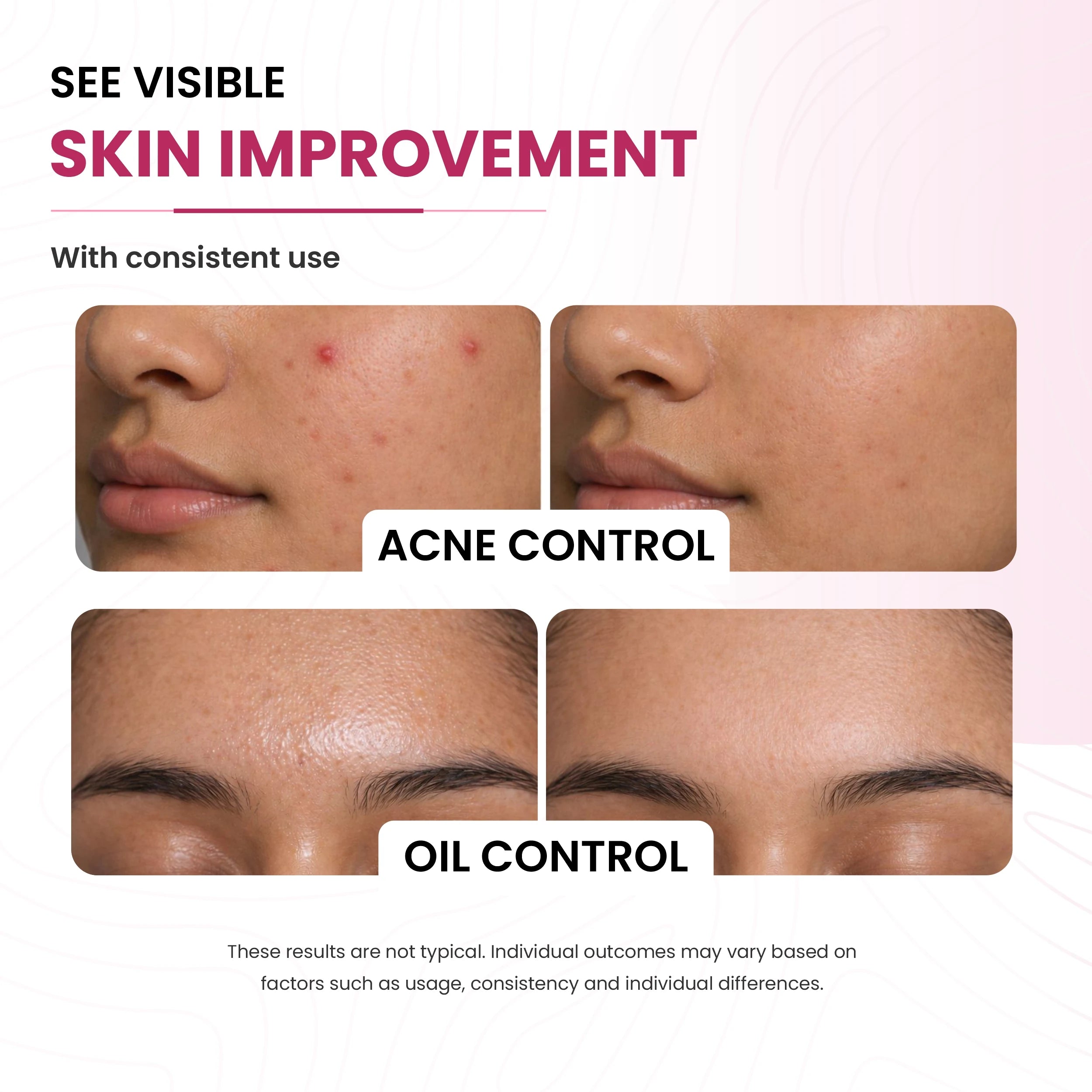 Glow & Hydrating Face Wash | 5% Niacinamide & 2% Salicylic Acid | Clear and Even Skin